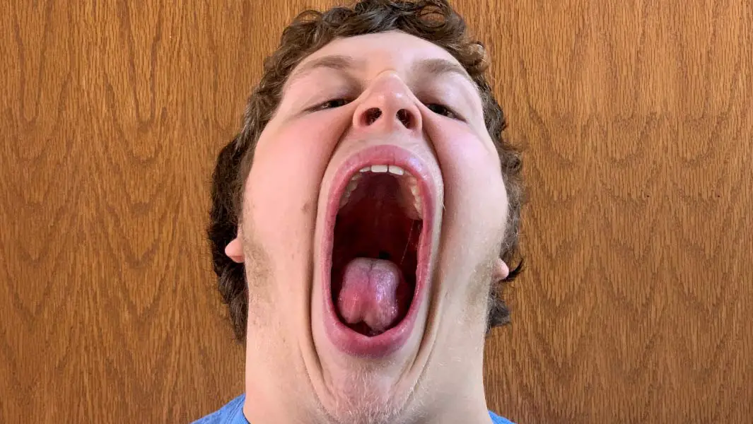 مراهق أمريكي يحقق رقماً قياسياً لأكبر فجوة فم