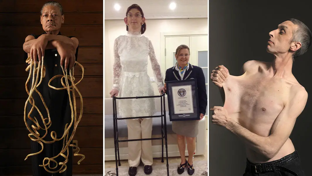 split image longest nails tallest teen stretchiest skin