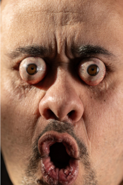 William from head-on