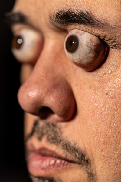 Side profile of William's eyes